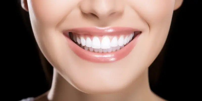 roznice-miedzy-licowkami-porcelanowymi-a-kompozytowymi-1