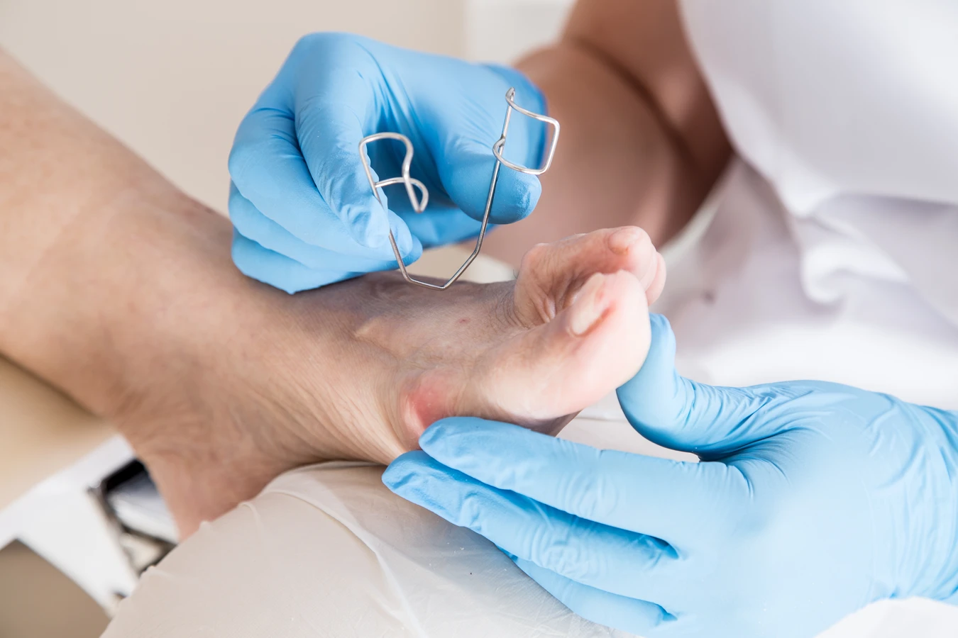 kiedy-nalezy-udac-sie-do-gabinetu-podologicznego-1