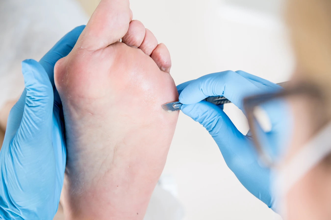 sonda-do-paznokci-do-czego-sluzy-co-warto-wiedziec-1