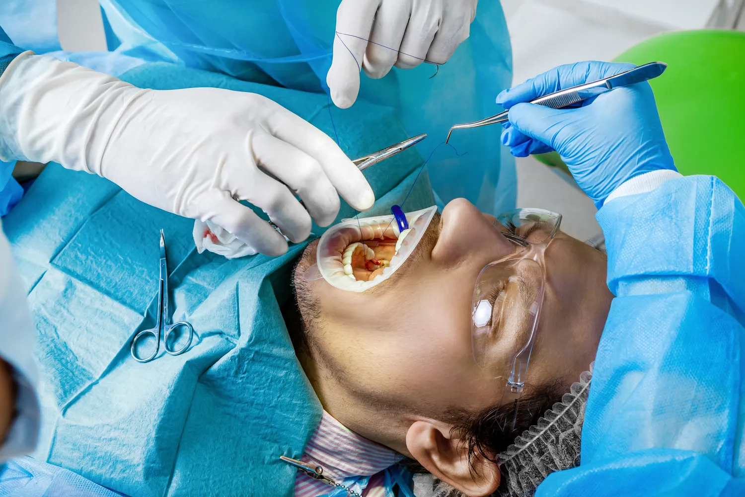 Jak dlugo wazna jest e recepta?