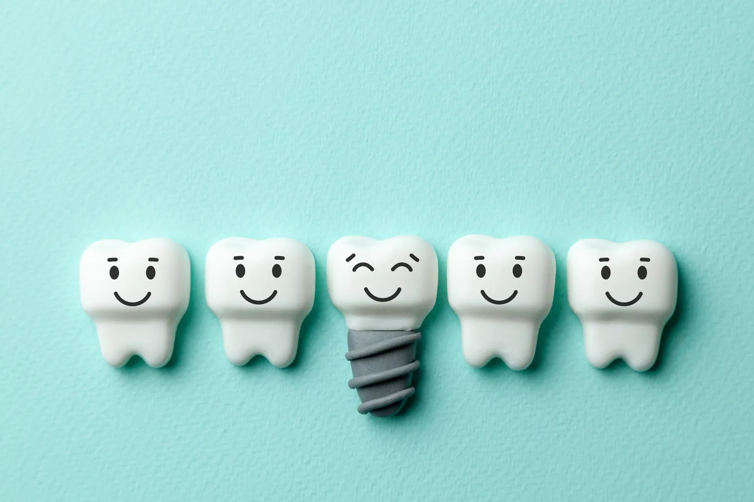 implanty-zebowe-poznaj-ich-zalety-oraz-wady-f